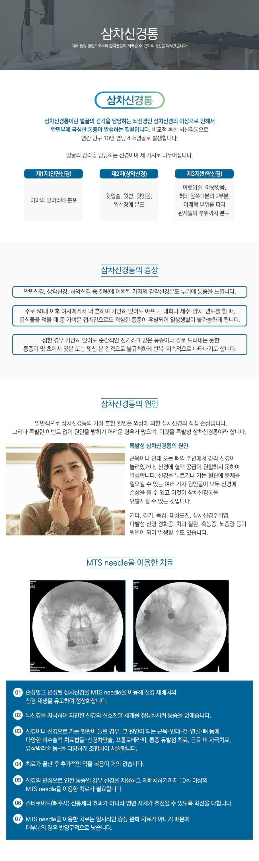 삼차신경통