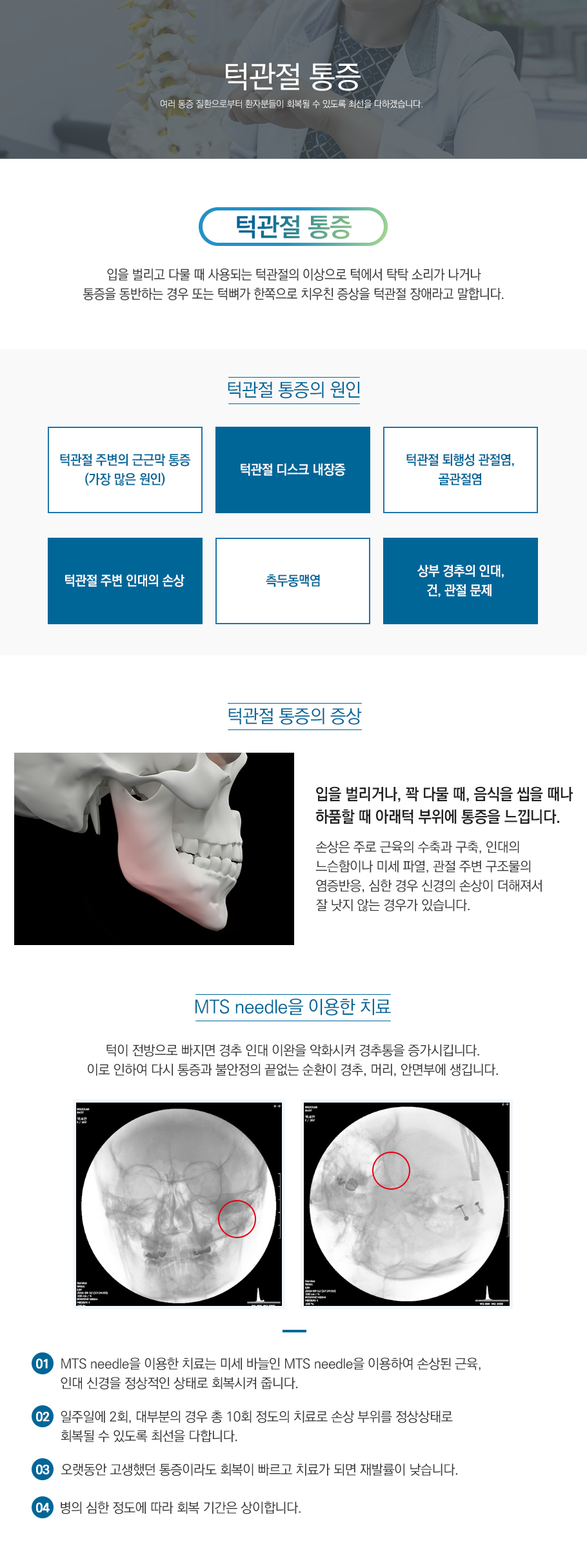 턱관절통증