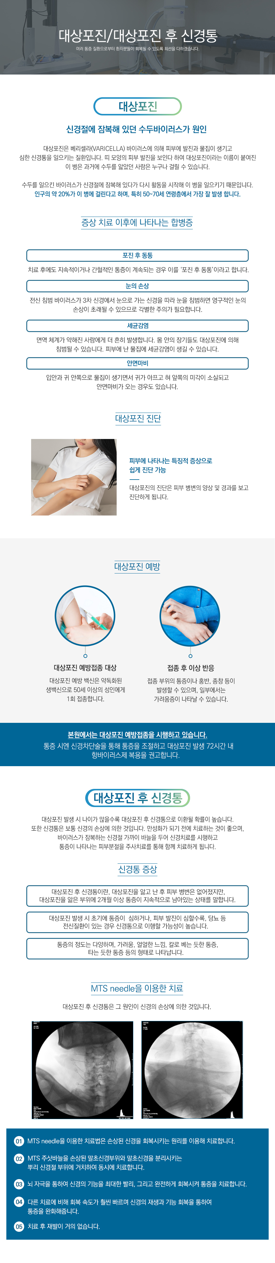 대상포진