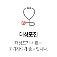 대상포진